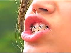 Girl mit Zahnregulierung bei hartem Fick